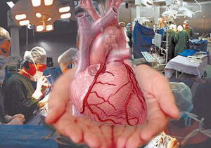 трансплантация органов