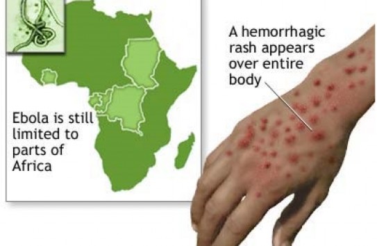 {Лихорадка Эбола: бактериологическое оружие? } Молдавские Ведомости